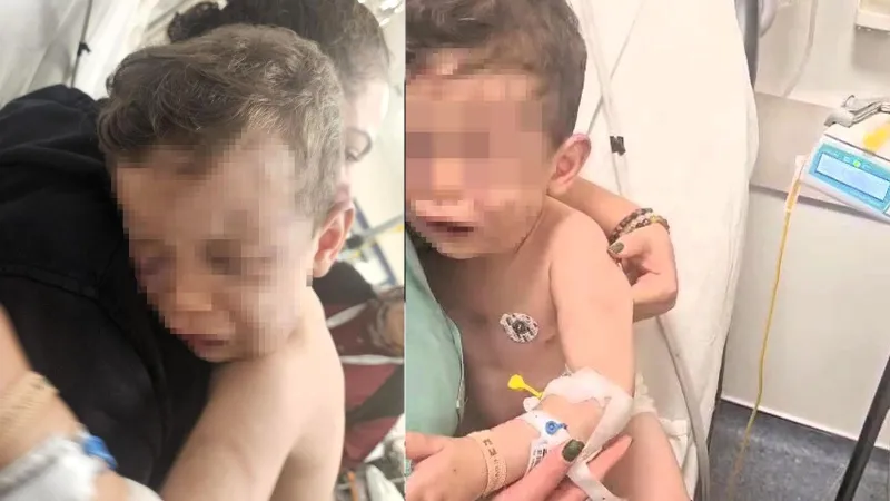 Aren Bebek Şiddeti: Annesi ve Sevgilisi Gözaltında! Şok Detaylar